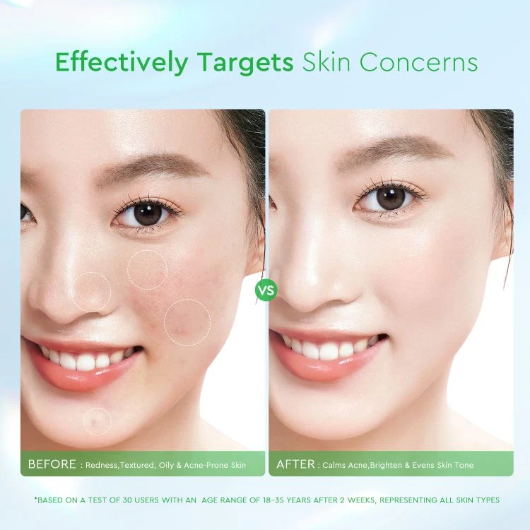 GLAD2GLOW CENTELLA SALICYLIC ACID EXFOLIATING ACNE PADS 30 PCS - Image 6