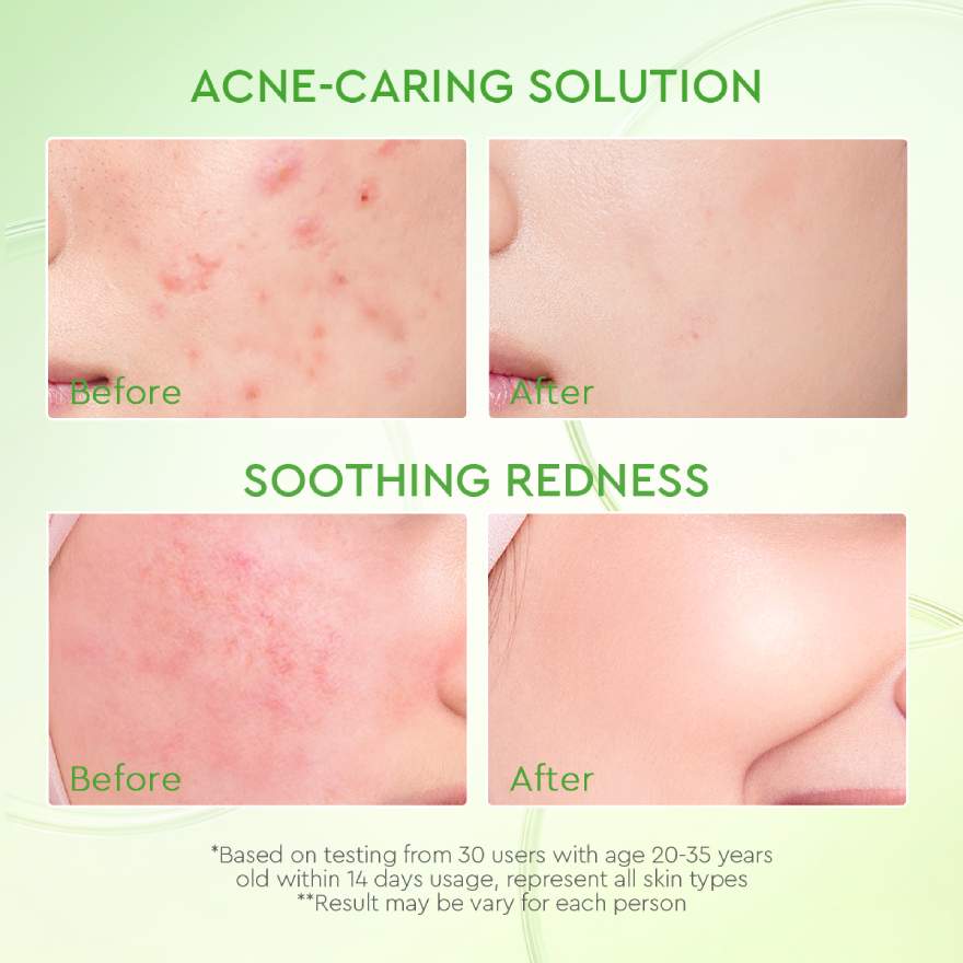 GLAD2GLOW KIWI 3D ACID ACNE MOISTURIZER 30G - Image 5